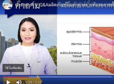 Q & A ผลิตภัณฑ์ แอลจี้รีมูฟเวอร์
